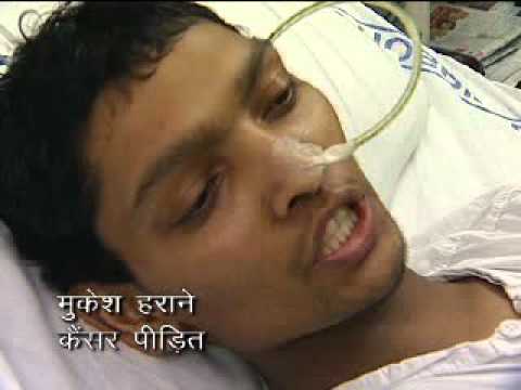 India - Mukesh: Smokeless Tobacco Campaign (Hindi) - Testimonial